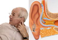 Hearing-Loss